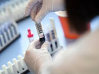 На Кубани число заболевших коронавирусом перевалило за сотню