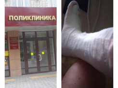 Пришел на перевязку – ушел с гипсом: новороссиец о случае в поликлинике 