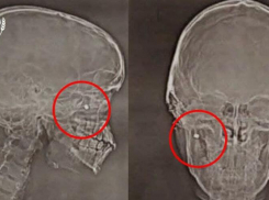 Новороссийский школьник получил пулевое ранение во время сдачи ГТО