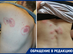 «Меня приковали обманом», - о квесте новороссийцам напоминают следы укусов и кровоподтёки