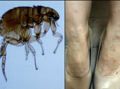 Блохи грызут новороссийцев заживо