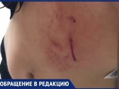 «При прыжках в воду людей цапает знатно»: на пляже в Новороссийске ребенка укусила собака