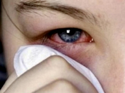 Ожоги глаз из-за кварцевой лампы получили школьники у соседей Новороссийска 