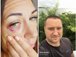 «Не хочу, чтобы другая оказалась на моём месте», - на жительницу Новороссийска напал бывший муж