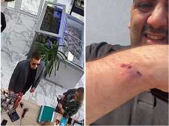 «Я думал, это шутка!»: избитый выдвиженец в депутаты Новороссийска рассказал о нападении