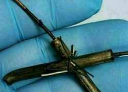 Новороссиец "случайно" проглотил провода и чуть не умер 