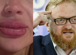 За «утиные губы» - в «психушку»: что об идее депутатов думают новороссийские косметологи