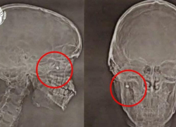 Новороссийский школьник получил пулевое ранение во время сдачи ГТО