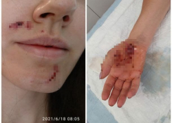 Слабонервным не смотреть: в Новороссийске бойцовская собака напала на женщину