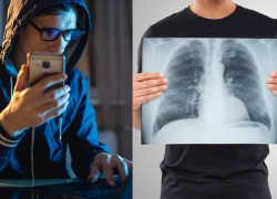 При записи на флюорографию новороссийцы могут лишиться денег