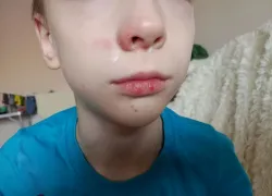 «По тонкому льду»: в Новороссийске школьники пятой гимназии получили травмы