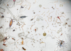 Новороссийцы в этом плавают — снимок морской воды под микроскопом