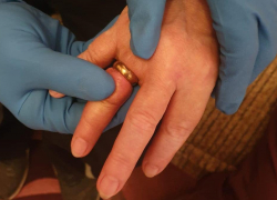 В Новороссийске прошла операция по спасению пальца от обручального кольца