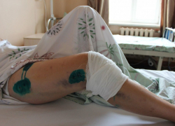 Сбил девушку – и скрылся. Полиция Новороссийска обращается за помощью в розыске