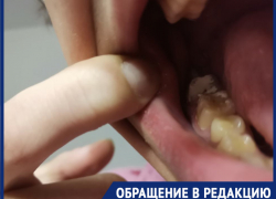 Может, тебе еще сплясать: жительница Новороссийска возмущена отношением стоматолога из местной поликлиники