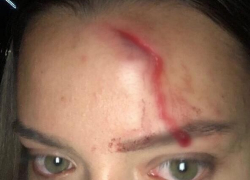 «Ты же знаешь, как решаются армянские дела…» - пострадавшей работнице тира в Анапе угрожают