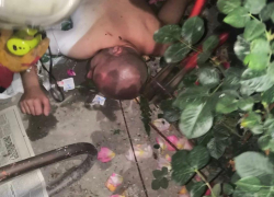 "Проволока вошла ему в тело": новороссийца спасали во дворе собственного дома