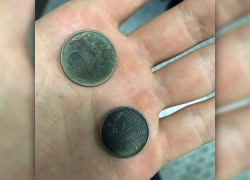 Новороссийские медики спасли малыша, проглотившего две монеты