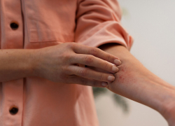 Может ли оспа обезьян добраться до Новороссийска - прогнозы врачей