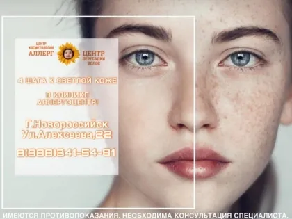 Пигментация кожи: в «АллергоЦентре» Новороссийска знают, как с этим бороться
