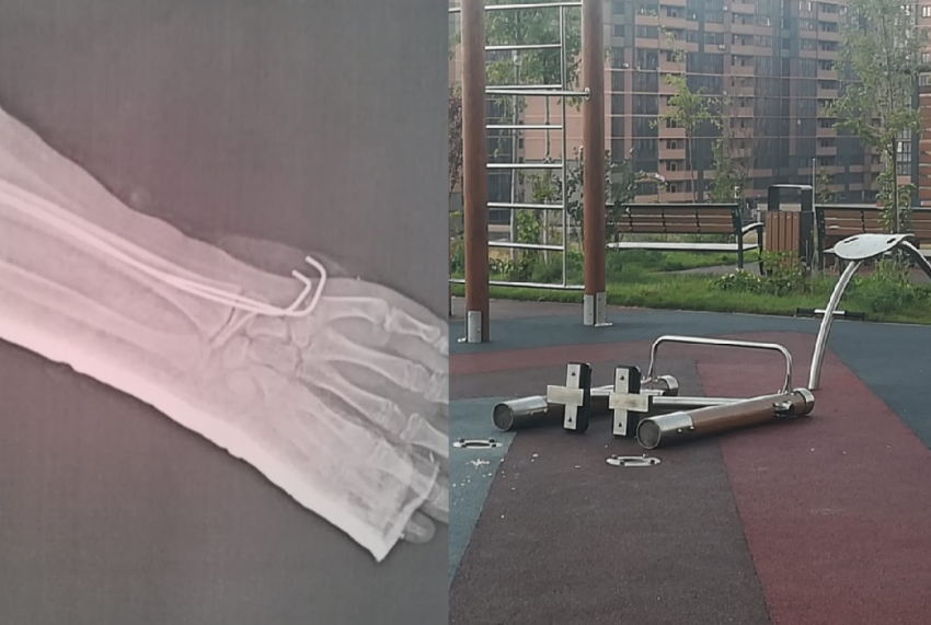 "Этот тренажер калечит детей!": на площадке в Новороссийске ребенок сломал руку