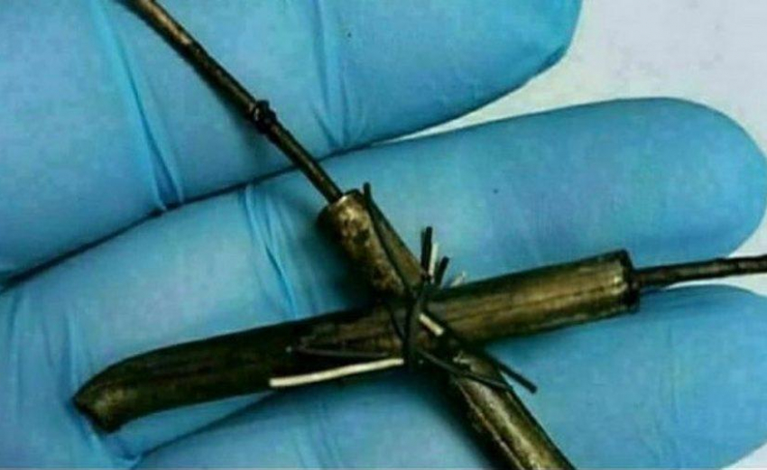 Новороссиец «случайно» проглотил провода и чуть не умер 