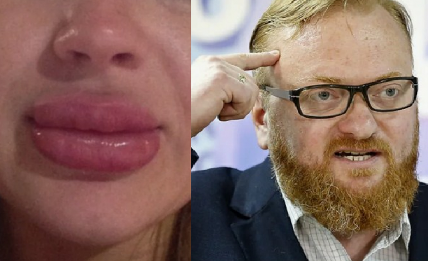 За «утиные губы» - в «психушку»: что об идее депутатов думают новороссийские косметологи