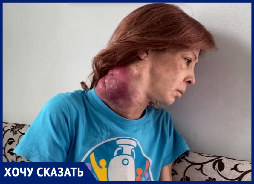 Положите меня, она растет: онкобольная жительница Новороссийска просит о помощи