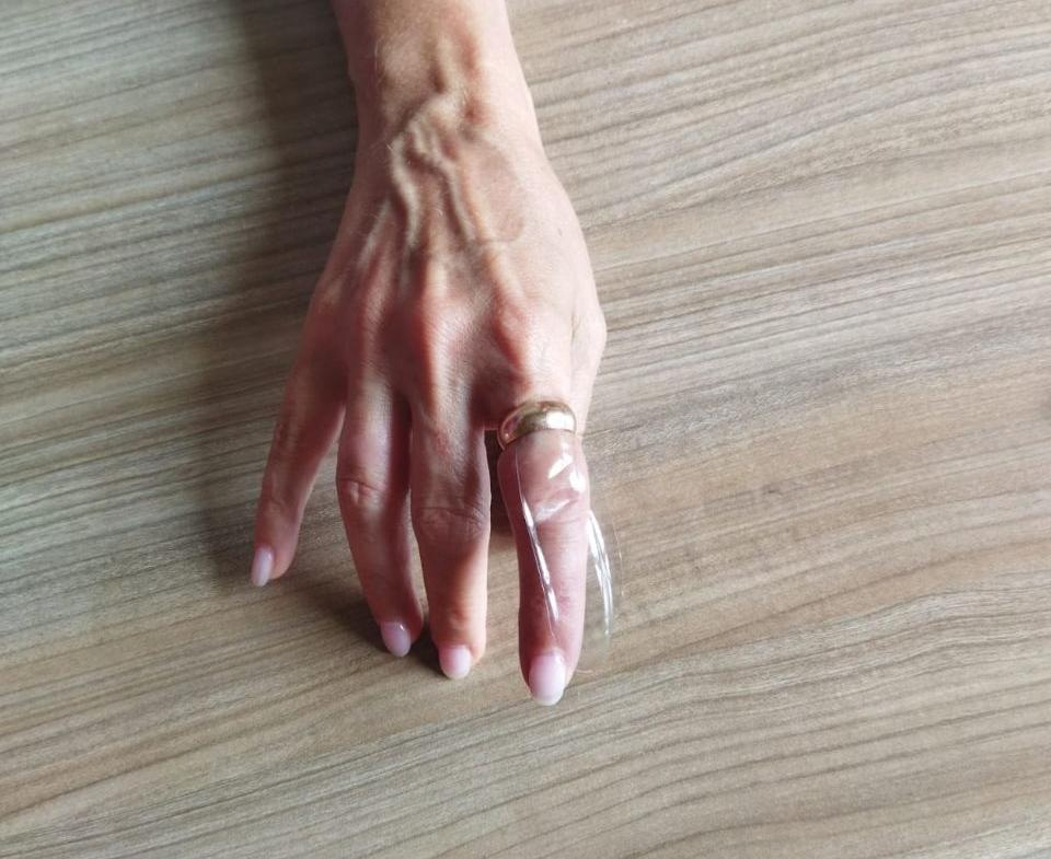Спасатели уберегли жительницу Новороссийска от некроза тканей: почему кольца застревают на пальцах